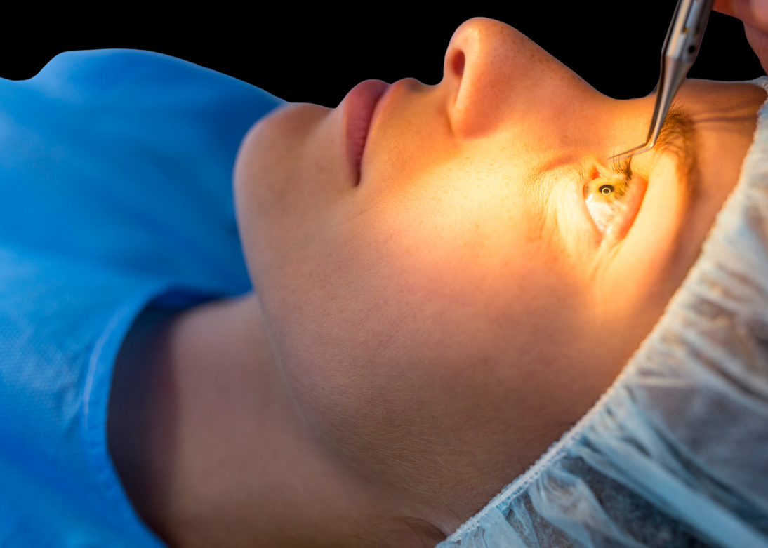 Refractive Surgery